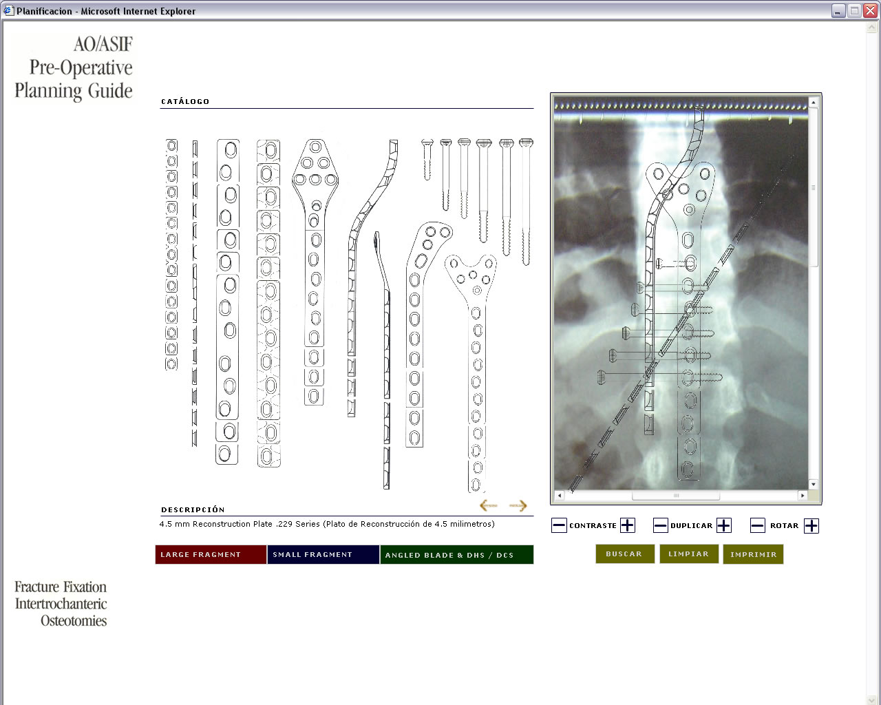 Preoperative Planning Tool